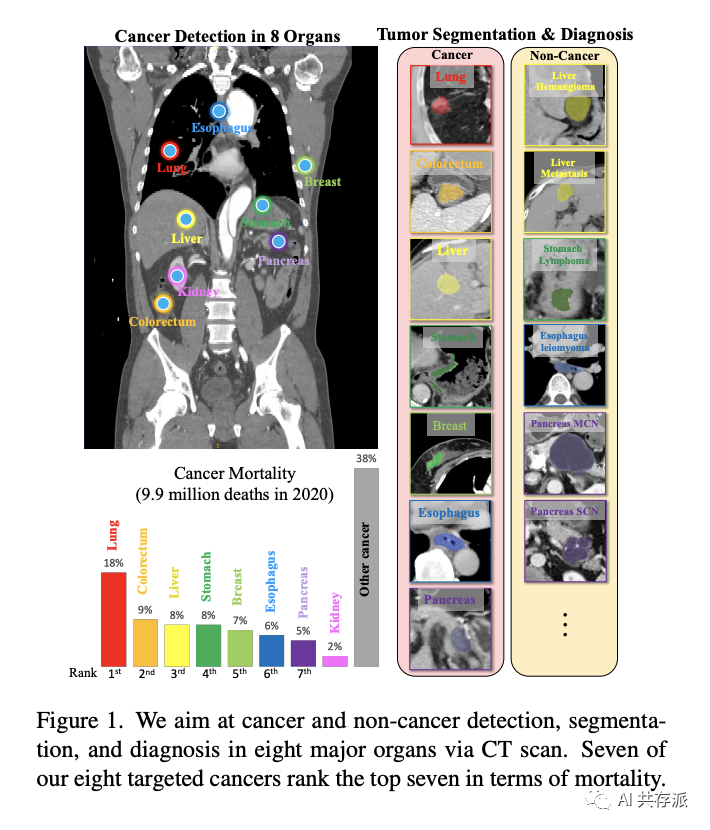 阿里达摩院今日发布多癌影像分析通用模型，可检测、分割和诊断八种主要的高发致死癌症